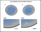 streptococci latex agglutination